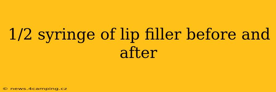 1/2 syringe of lip filler before and after