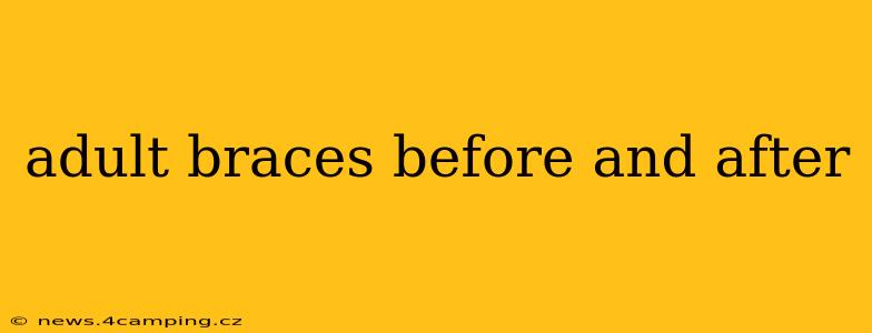 adult braces before and after