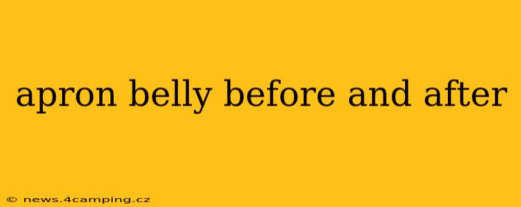 apron belly before and after
