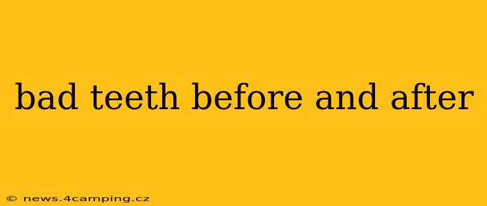 bad teeth before and after