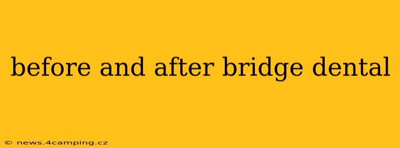before and after bridge dental
