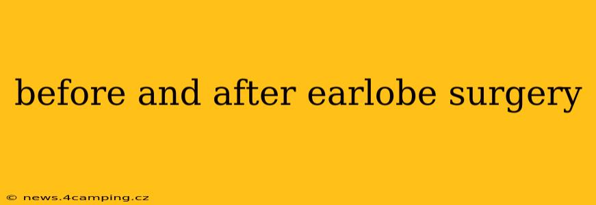 before and after earlobe surgery