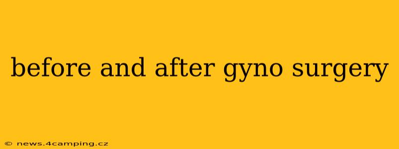 before and after gyno surgery