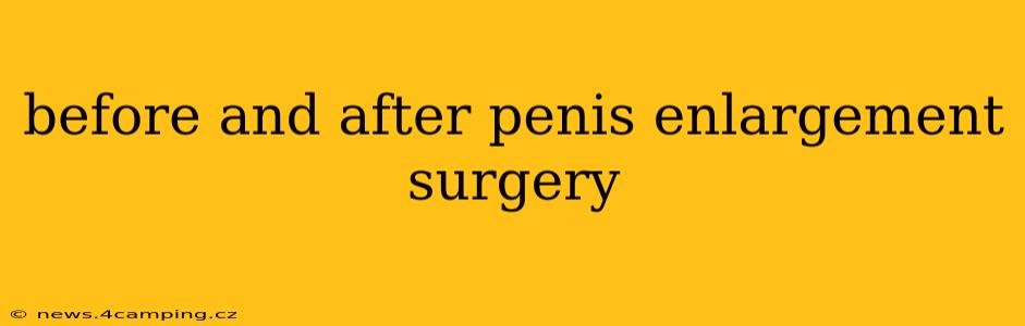 before and after penis enlargement surgery