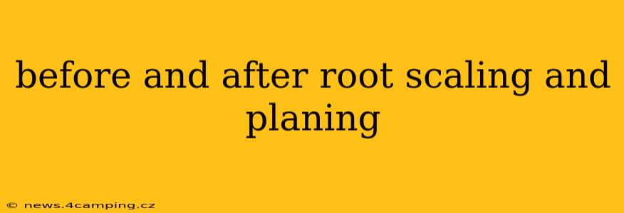 before and after root scaling and planing