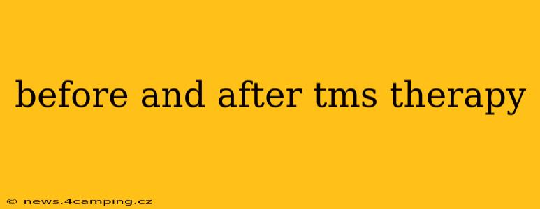 before and after tms therapy