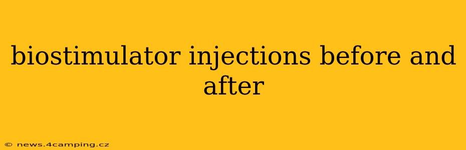 biostimulator injections before and after