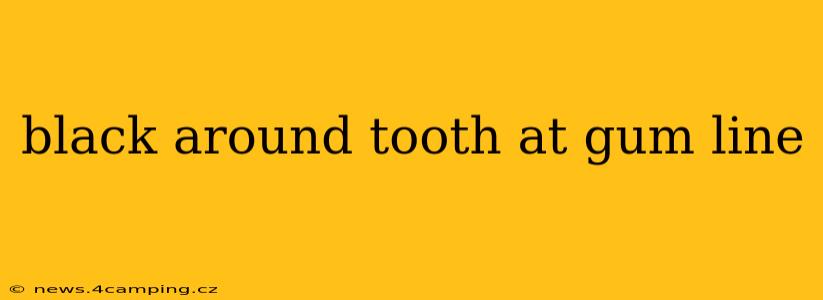 black around tooth at gum line
