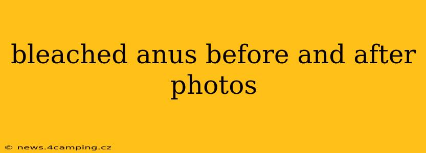 bleached anus before and after photos