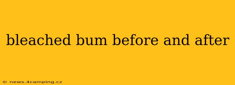 bleached bum before and after