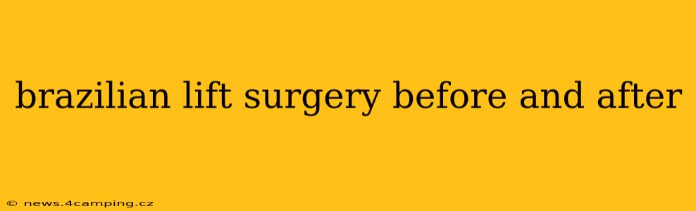 brazilian lift surgery before and after