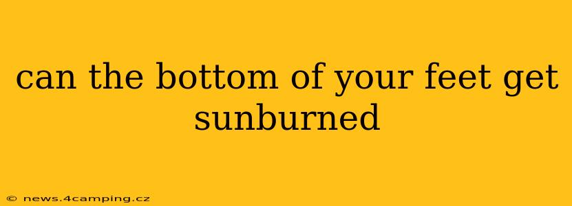 can the bottom of your feet get sunburned