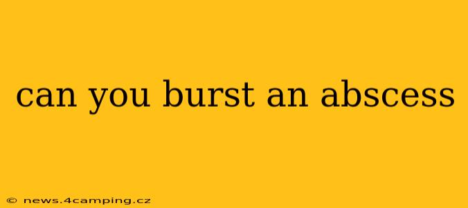 can you burst an abscess