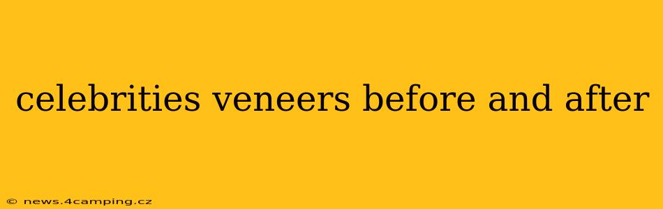 celebrities veneers before and after