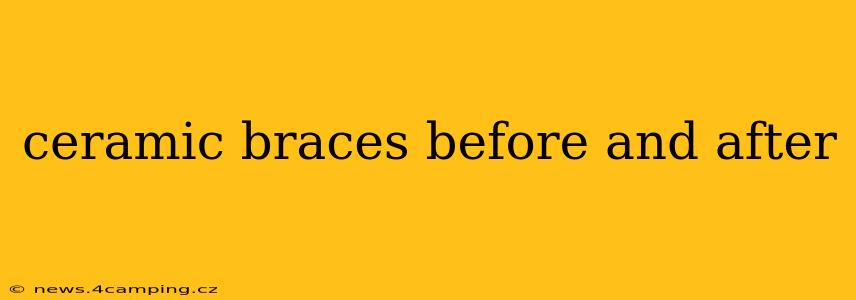 ceramic braces before and after