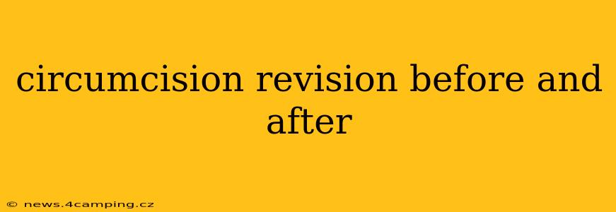 circumcision revision before and after