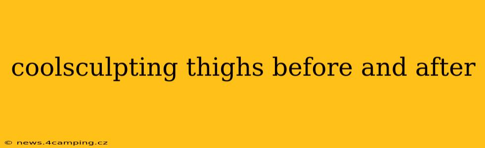 coolsculpting thighs before and after