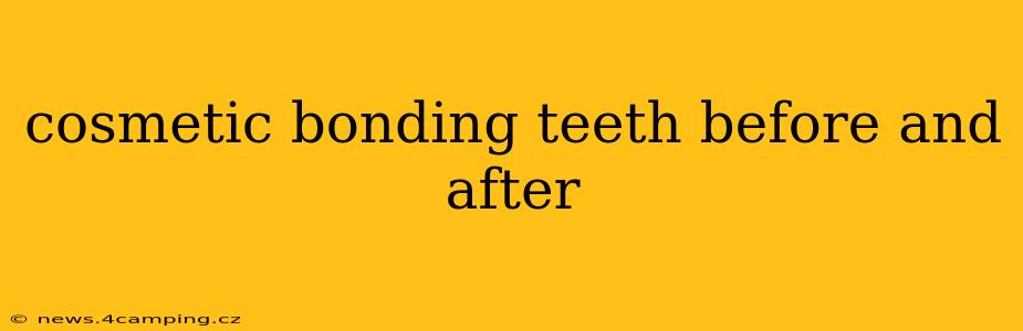 cosmetic bonding teeth before and after