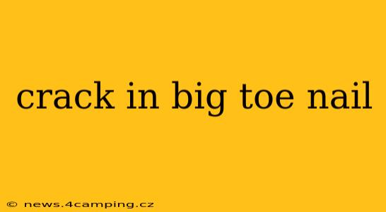 crack in big toe nail
