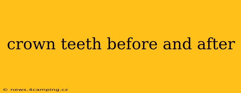 crown teeth before and after