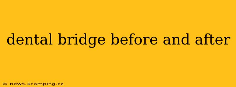 dental bridge before and after