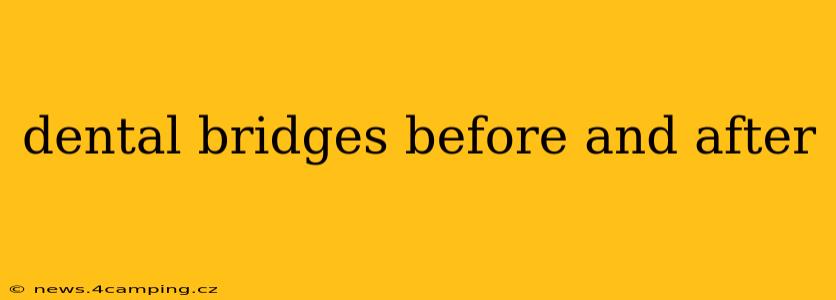 dental bridges before and after