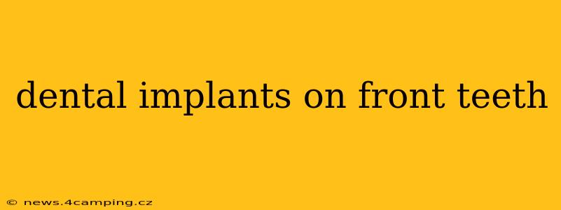 dental implants on front teeth