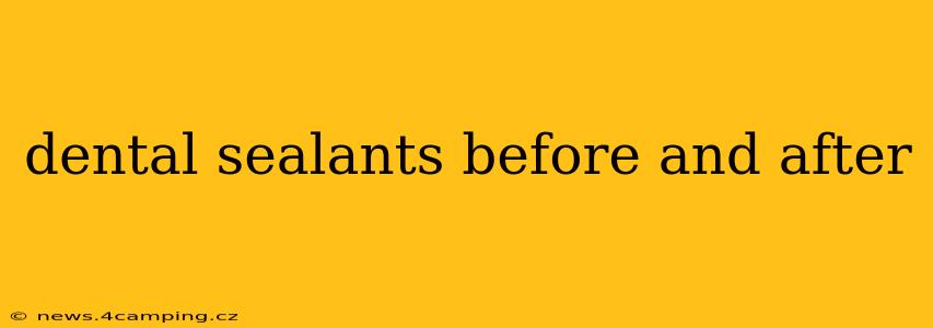 dental sealants before and after