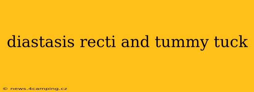diastasis recti and tummy tuck