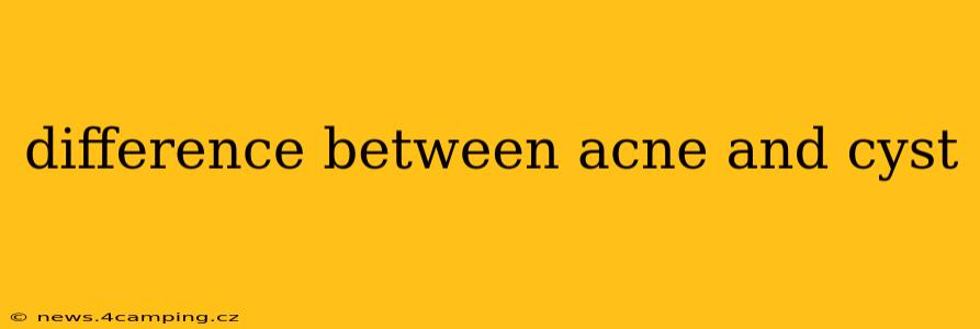 difference between acne and cyst