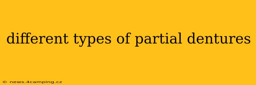 different types of partial dentures