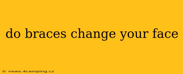 do braces change your face