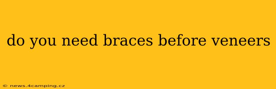 do you need braces before veneers