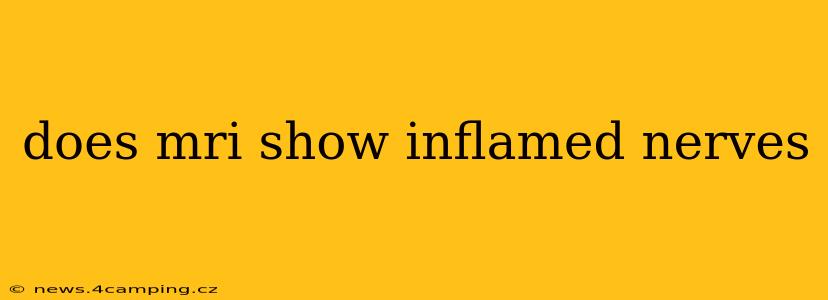 does mri show inflamed nerves