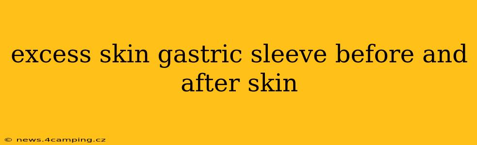 excess skin gastric sleeve before and after skin