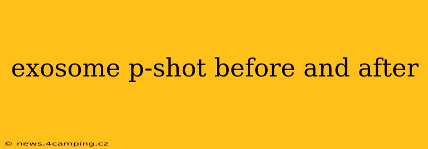 exosome p-shot before and after