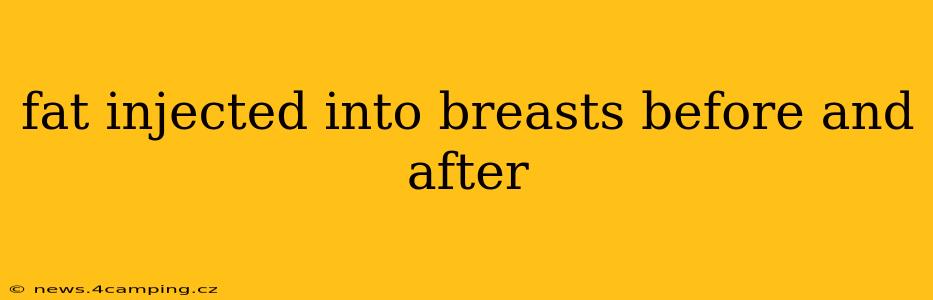 fat injected into breasts before and after