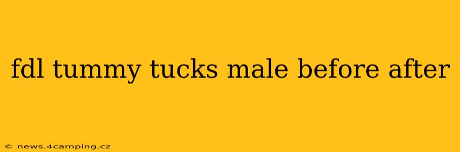 fdl tummy tucks male before after