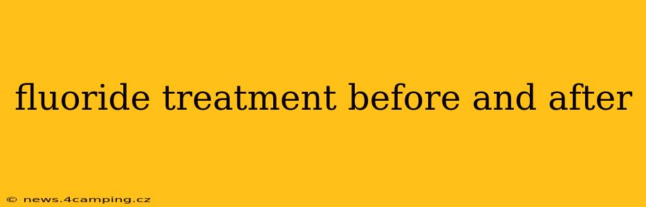 fluoride treatment before and after