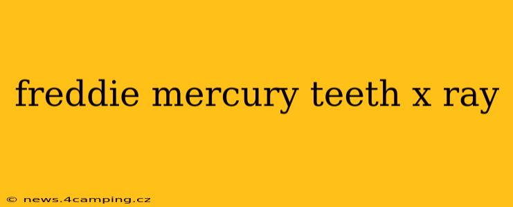 freddie mercury teeth x ray