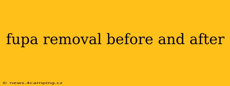 fupa removal before and after