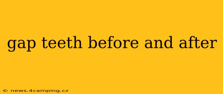 gap teeth before and after