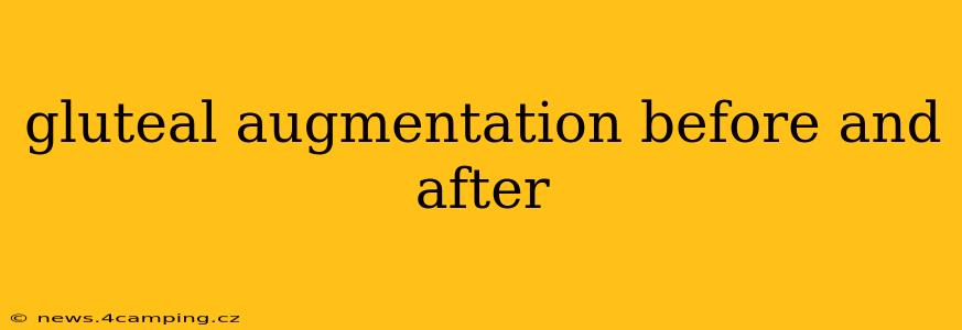 gluteal augmentation before and after