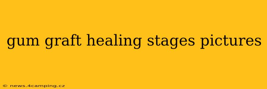 gum graft healing stages pictures