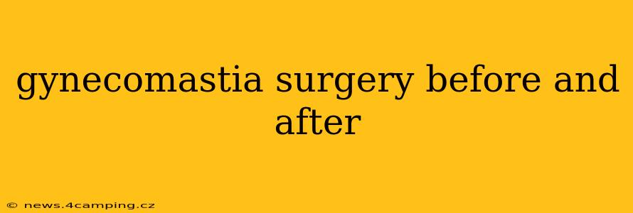 gynecomastia surgery before and after