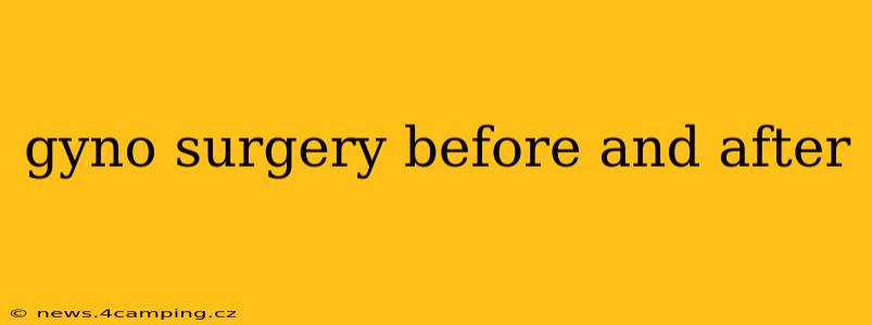 gyno surgery before and after