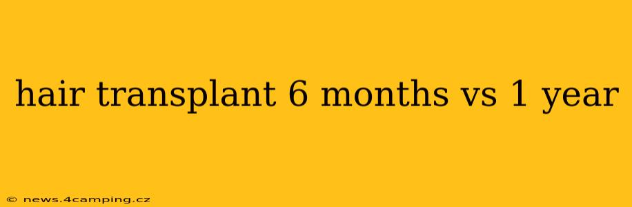 hair transplant 6 months vs 1 year