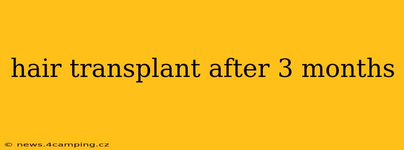 hair transplant after 3 months
