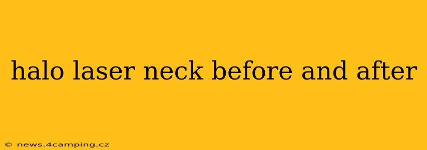 halo laser neck before and after