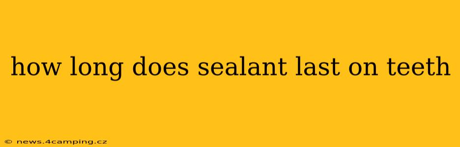 how long does sealant last on teeth